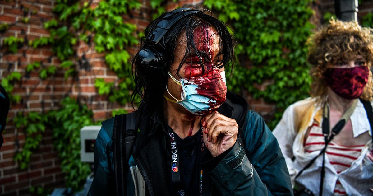 Journalists Across The Country Have Been Arrested And Injured By Police