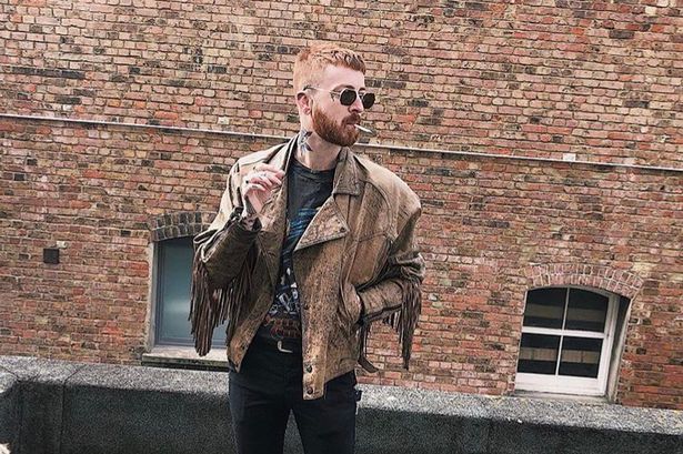 Man's legs compared to Drumstick sweets after sharing photos of horrific sunburn