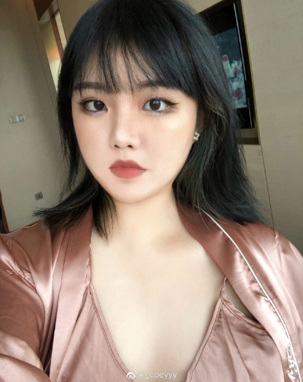 Rising Chinese influencer fat-shamed after extreme photo editing revealed on social media