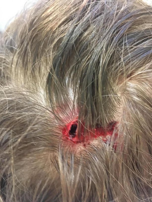 Schoolboy left with huge gash on head after 4ft tall white swan launches at him