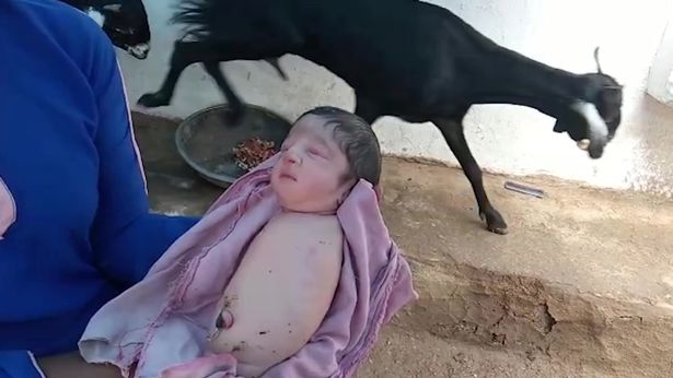 Baby girl born with no arms or legs due to rare disorder leaving medics stunned