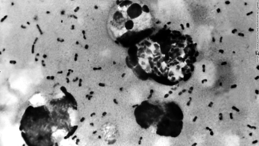 Chinese authorities confirm case of bubonic plague in Inner Mongolia