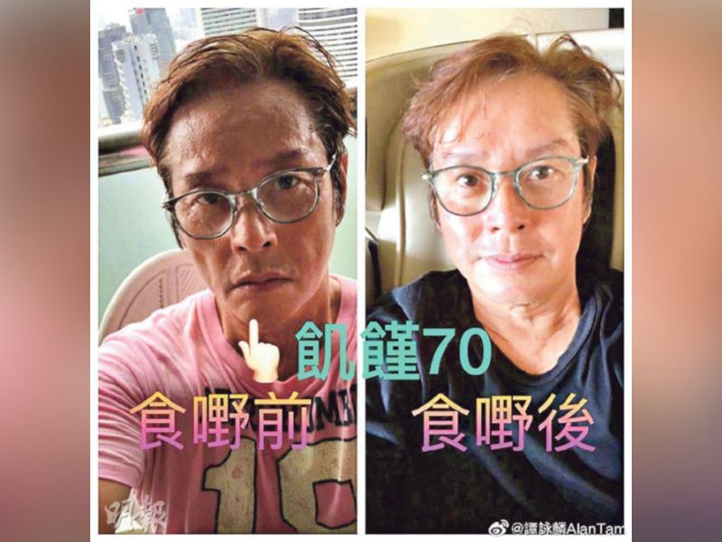 Alan Tam assures everyone he is healthy and fine