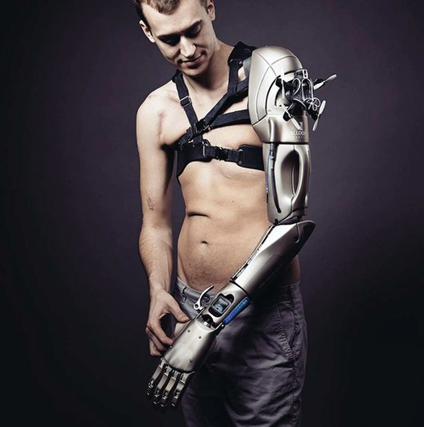 Bionic man who fell under train and lost leg and arm now transformed into bionic dad
