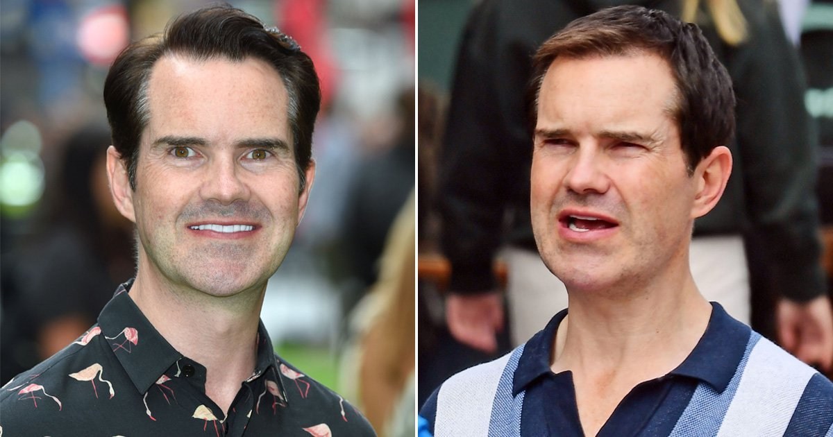 Jimmy Carr looking luscious on a lunch date after detailing hair transplant