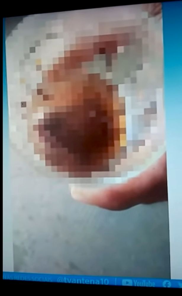 Woman 'bites off man's testicle' whilst fighting off an attempted rapist