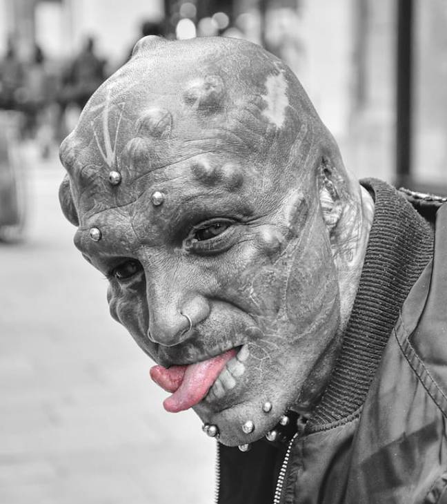 Man Who Has Transformed Himself Into 'Black Alien' Has Nose Removed