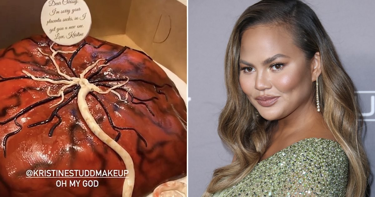 Chrissy Teigen sent ‘disgusting’ placenta cake by pal while she’s on bed rest and her reaction is everything