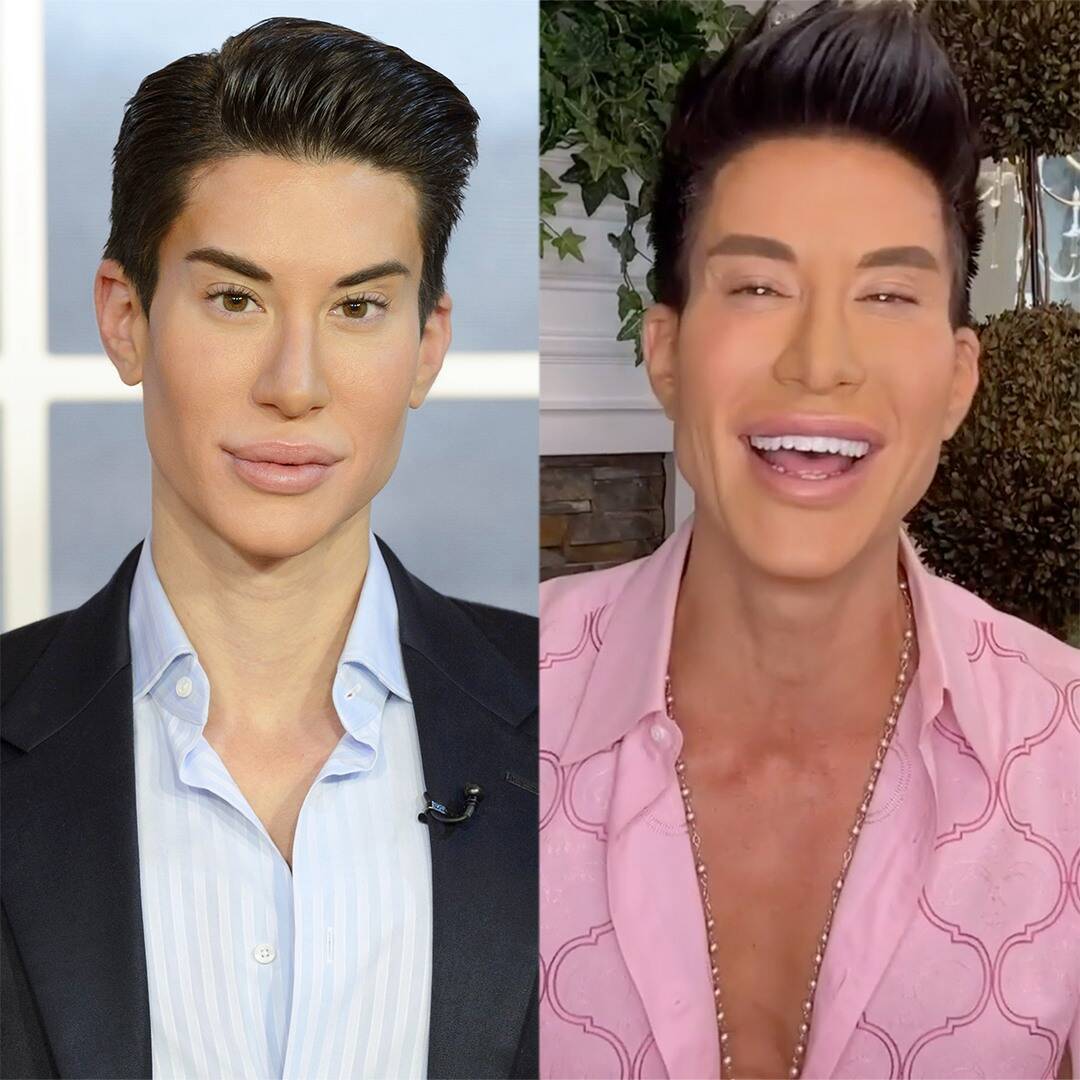 Human Ken Doll Is Back! Hear All About His 900+ Cosmetic Surgeries in Botched Sneak Peek