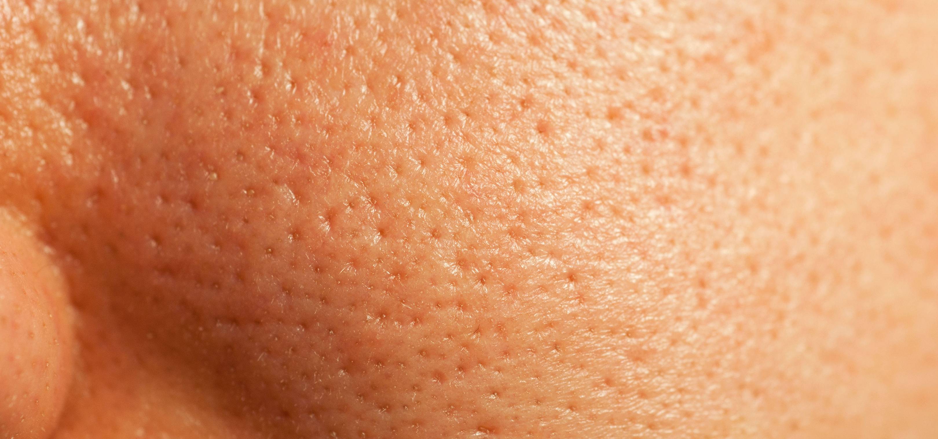 The expert-approved guide to your pores and how to make them less visible