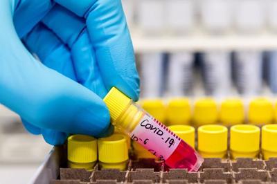 Covid-19: Shah Alam MP Khalid Samad tests negative after PCR test