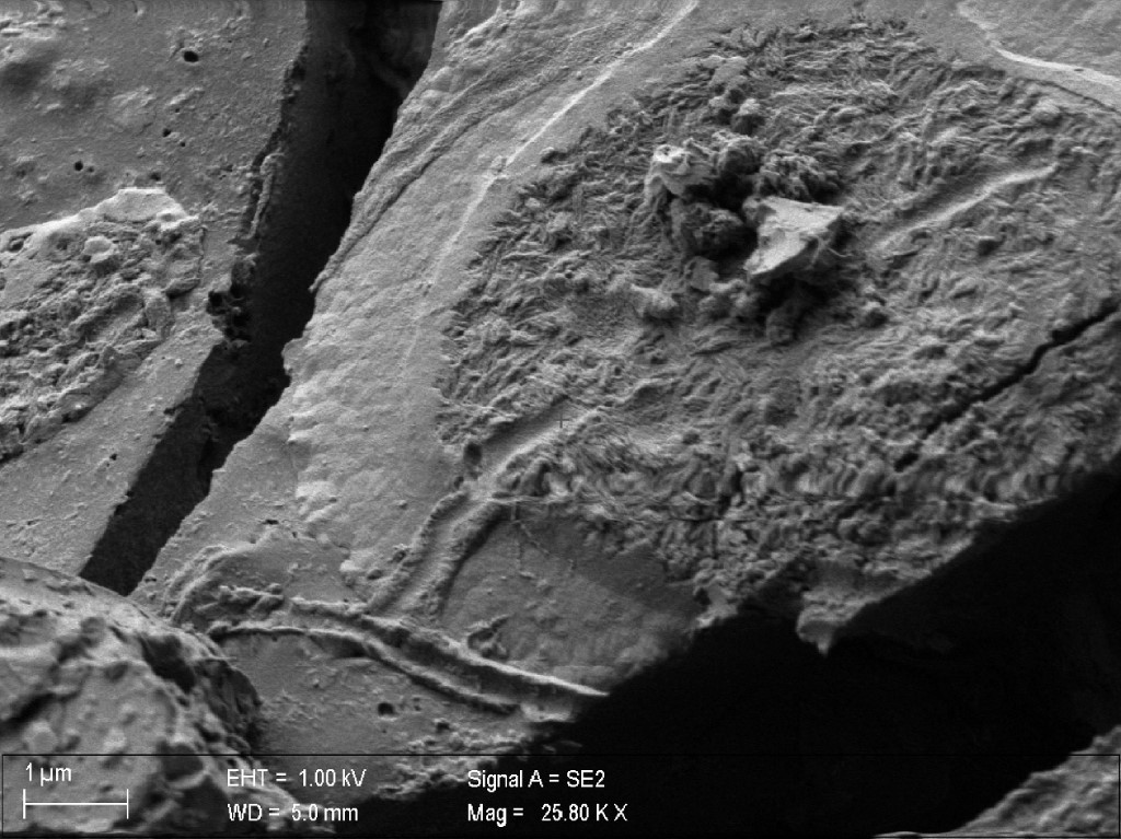 Study finds preserved brain material in Vesuvius victim - The Jakarta Post