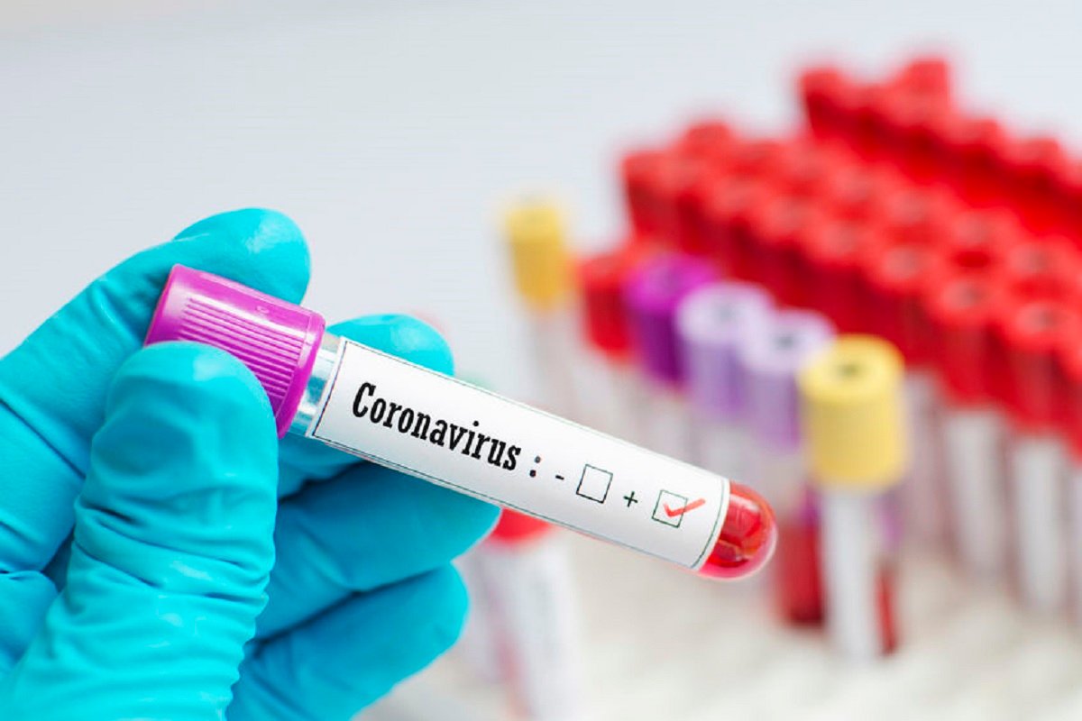 Bukit Gasing assemblyman subsidises Covid-19 testing for Selangor residents and others