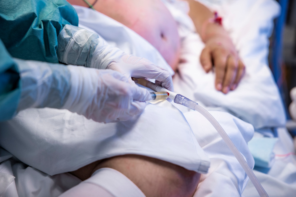 Oslo tightens up anti-Covid measures as cases rise