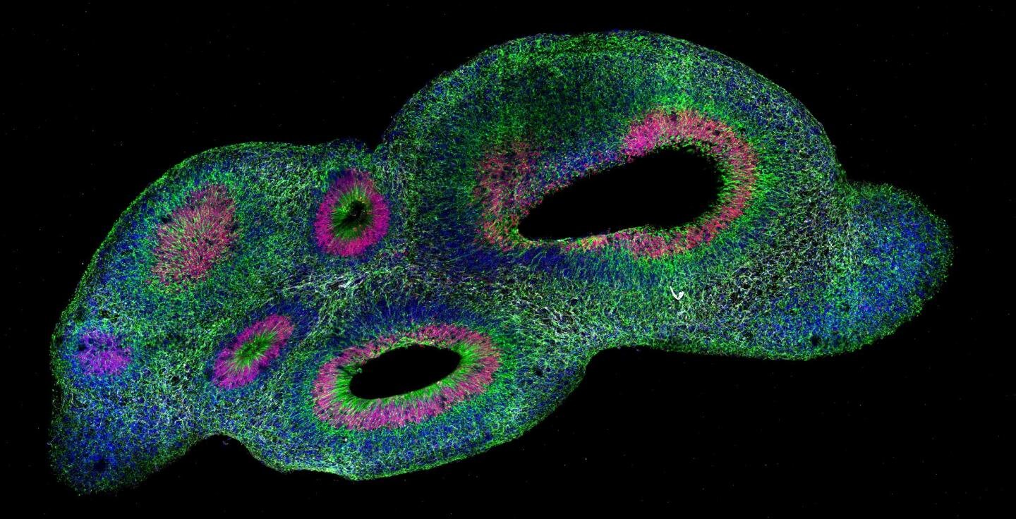 'SCOUT' helps researchers find, quantify significant differences among organoids