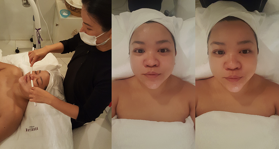 Best brightening facials in Singapore? We reviewed the best reviewed treatments and show you the result