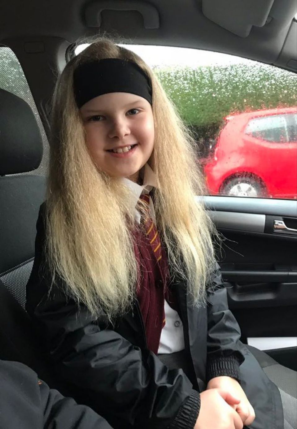 Girl with Uncombable Hair Syndrome is finally able to have her hair brushed after nine years