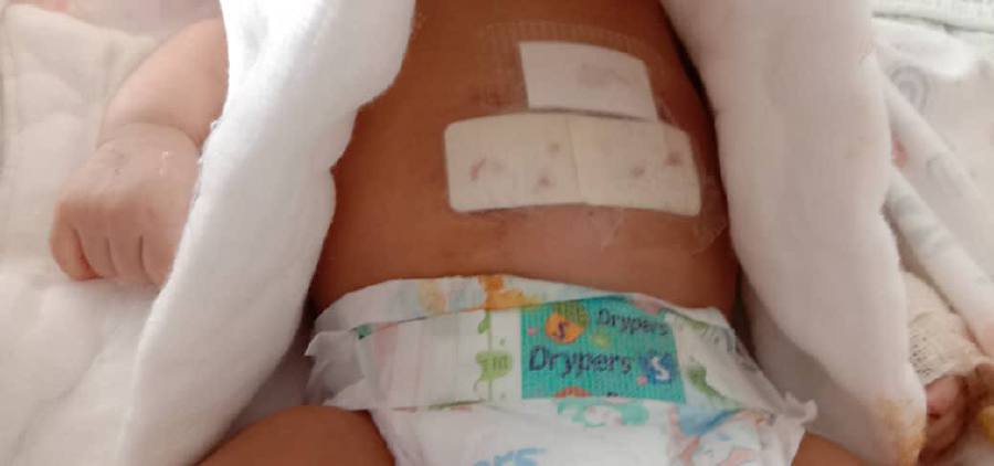 Baby seriously injured in Butterworth monkey attack