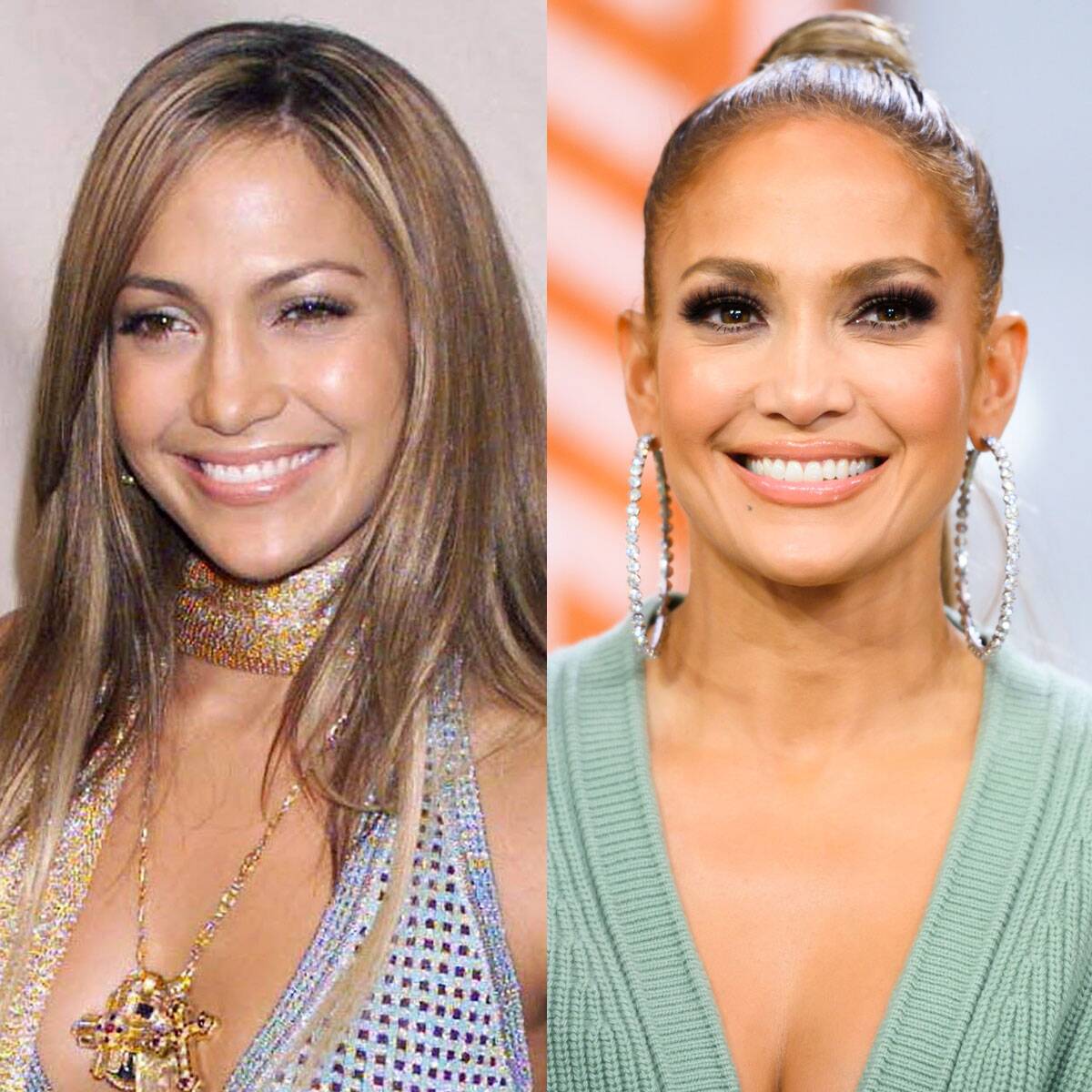 Jennifer Lopez Claps Back at Botox Claims and Also Denies Cosmetic Surgery