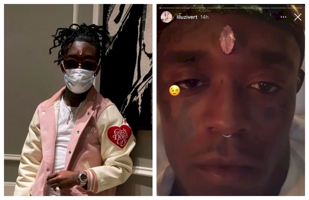 US rapper Lil Uzi Vert spends RM97m on pink diamond, implants it into forehead (VIDEO)
