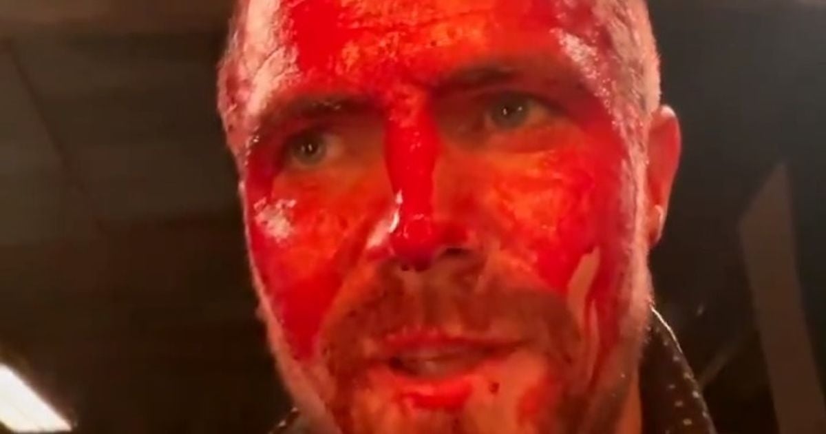 Stephen Amell Reveals Blood-Soaked Update From Wrestling Series Heels