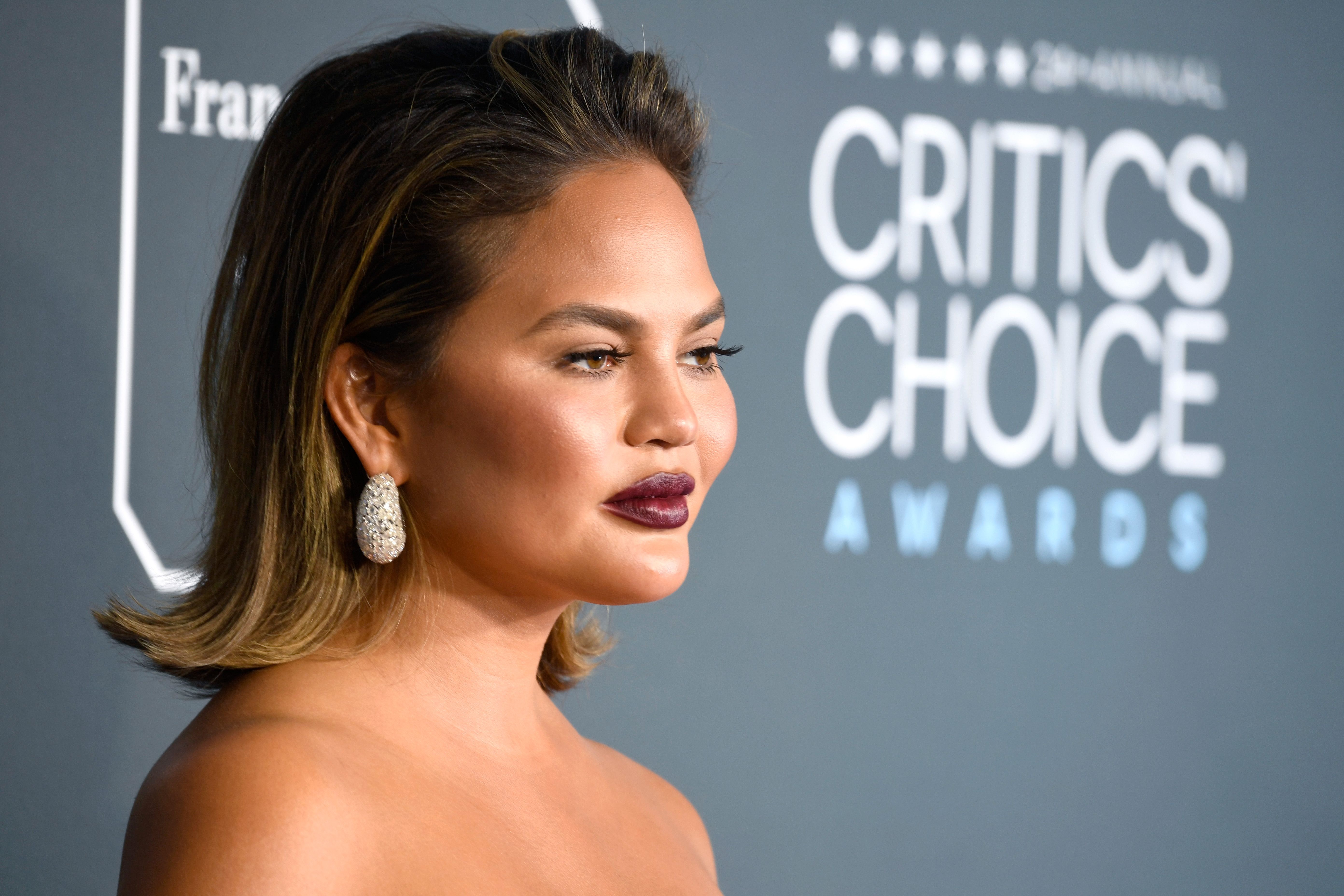 Chrissy Teigen Documents Her Recovery After Endometriosis Surgery