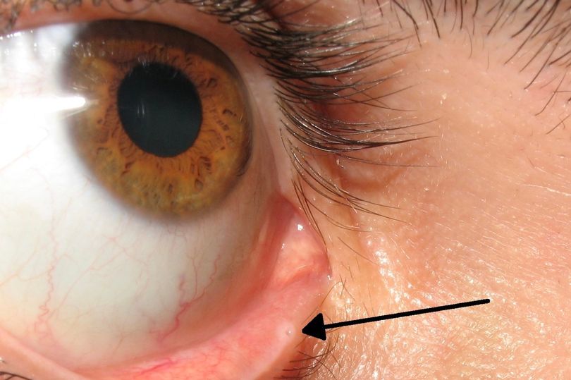 People are only just learning what the mysterious little holes in our eyelids really do