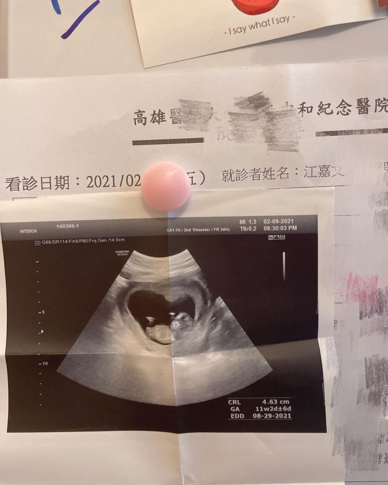 Taiwan trans influencer claims she is 'pregnant'