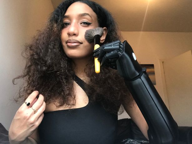Woman plagued by bullies for having no left hand now proud owner of £10,000 bionic arm