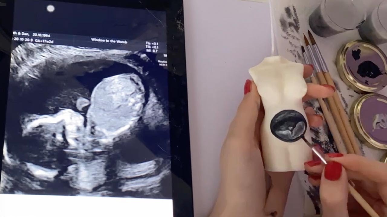 Creative Teen Paints Baby Ultrasound Scans Onto Candles