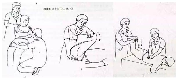 骶髂关节错位是下腰痛的原因之一