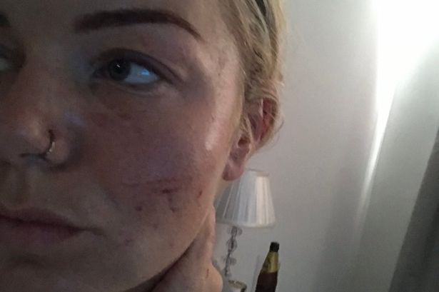 'My boyfriend knocked me unconscious in front of my screaming, terrified children'