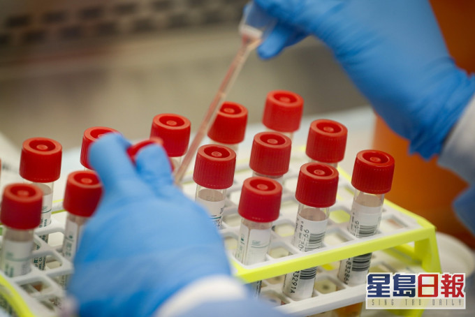 美国休斯敦超过一半污水处理厂检出英国变种新冠病毒