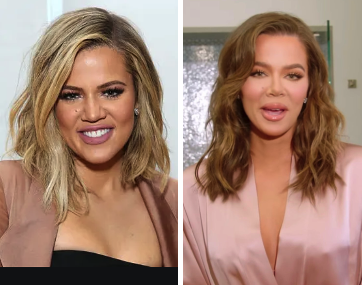 Did Khloe Kardashian Get a New Nose or Lip Job? Netizens Amused as She Debuts New Look