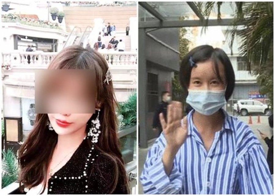 整形手术出意外　女子智商仅如1岁婴儿