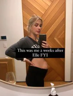Aussie Actress Calls Out Emily Ratajkowski's Flat Stomach 11 Days After Giving Birth