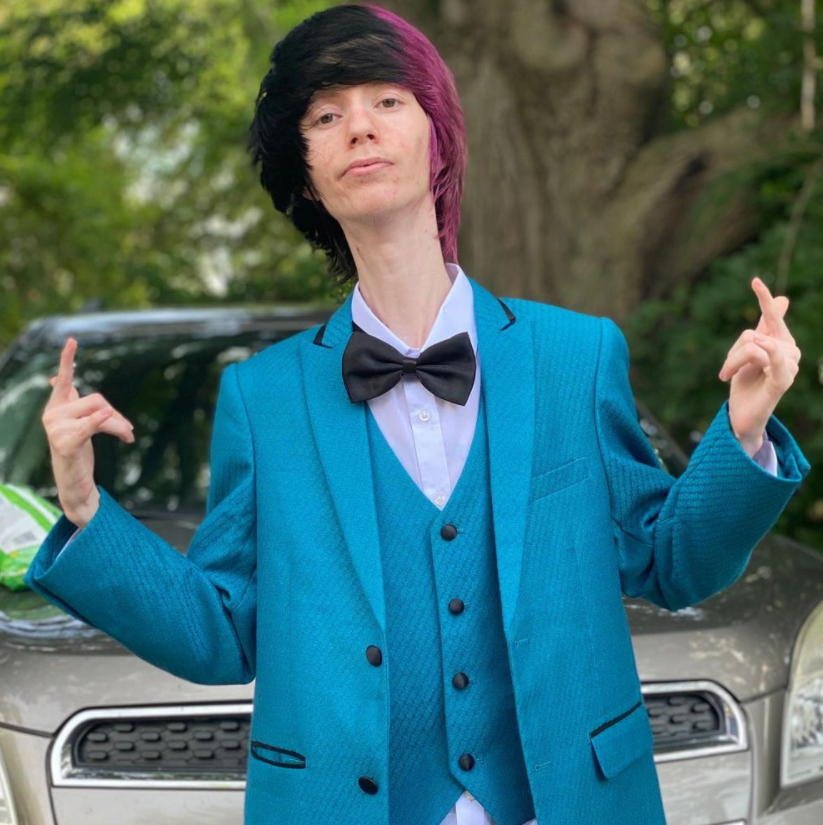 Viral Star Damn Long Neck Is Having A Baby