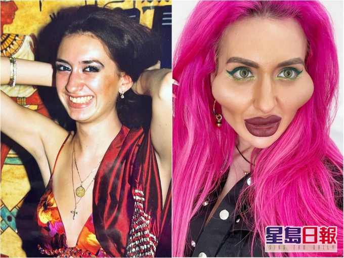 女网红整容变「世界最大脸颊」 过往素颜照曝光网民吃惊