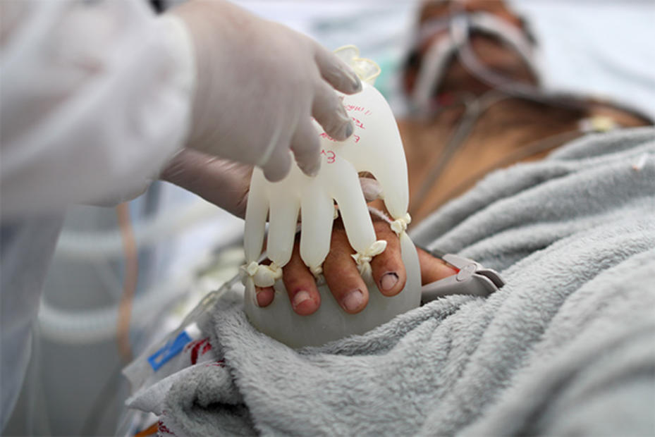'Hands of love': Warm latex gloves mimic human touch for Covid-19 patients in Brazil