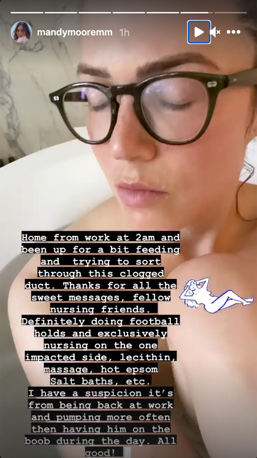 Mandy Moore Is 'Trying to Sort Through' a 'Clogged Duct' Between Breastfeeding and Pumping at Work