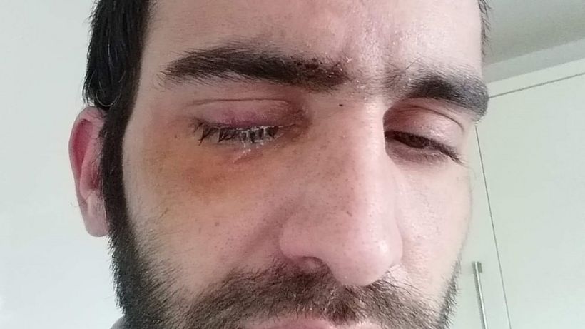 Man sentenced for blinding motorcyclist with egg in Wigston