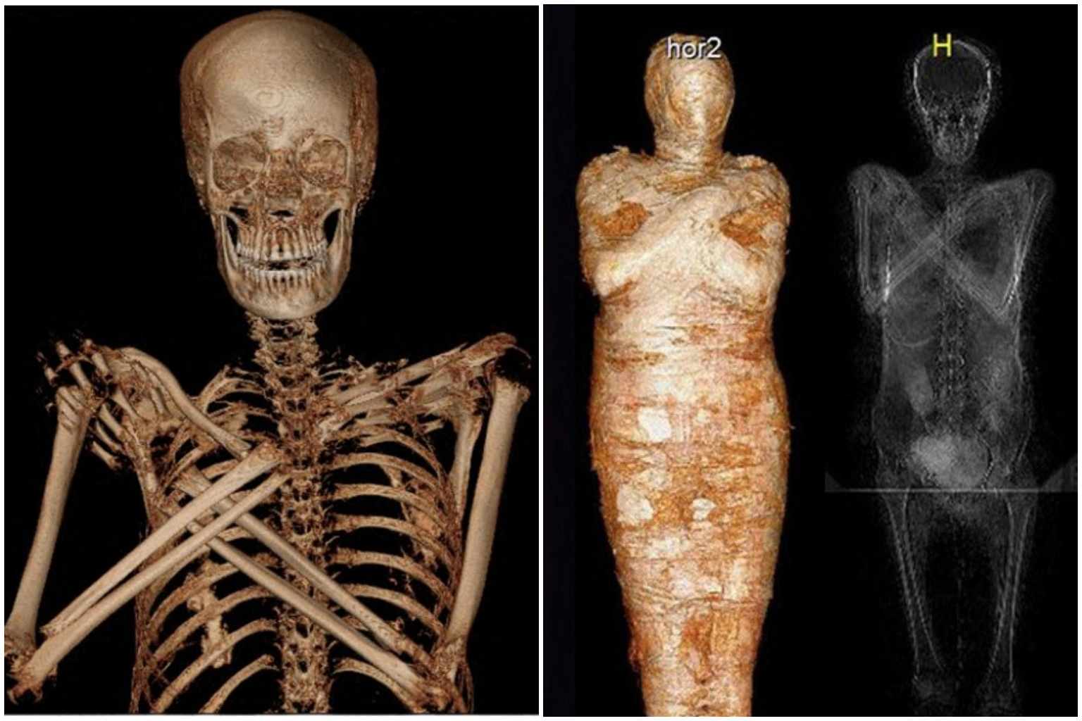 Mummy-to-be: Pregnant embalmed body identified in Poland