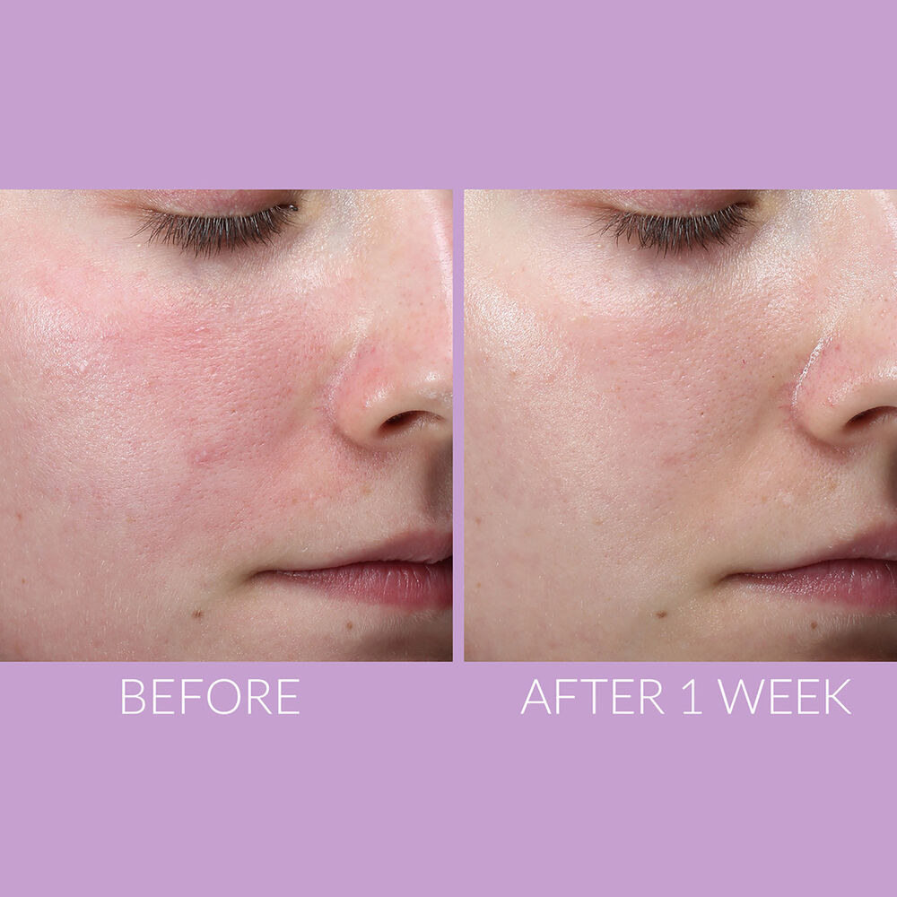 30 Skincare Products Reviewers With Sensitive Skin Swear By