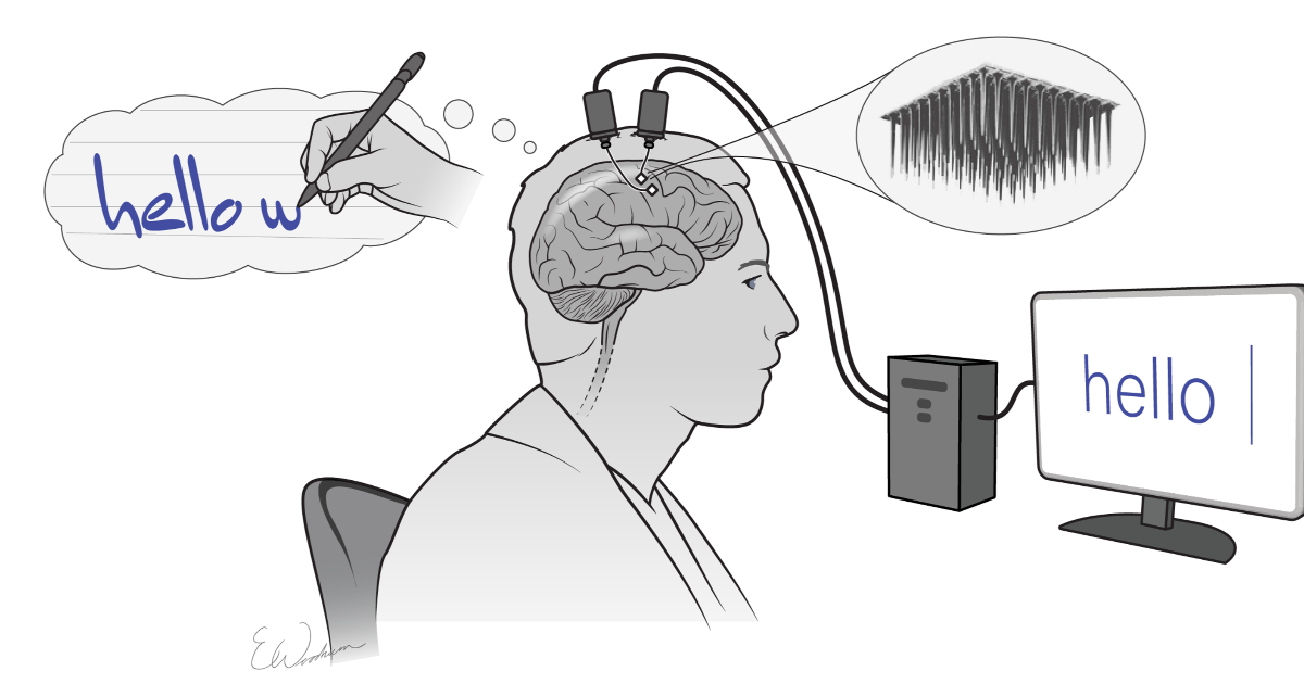 Brain implants let paralyzed man write on a screen using thoughts alone