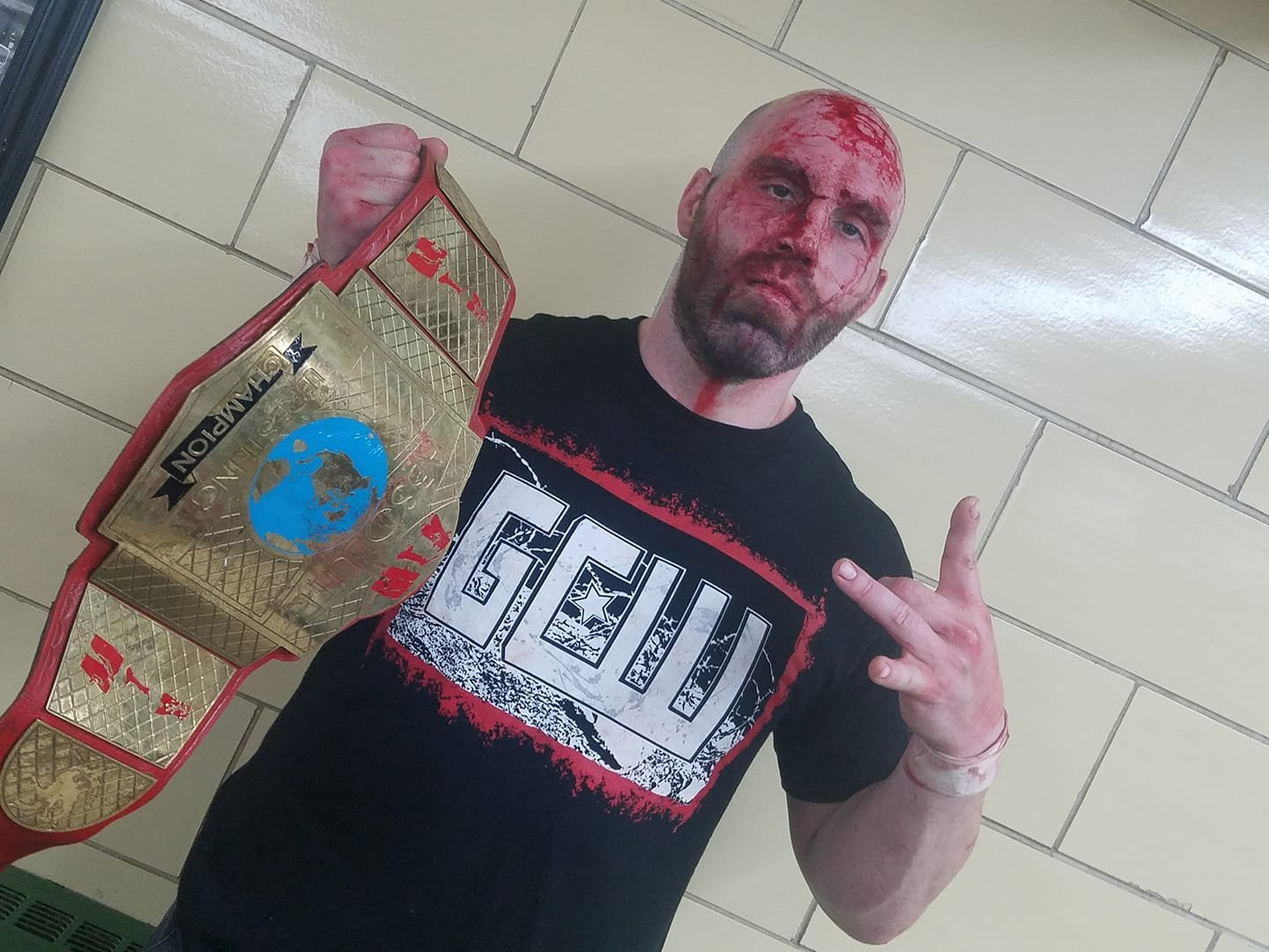 Dark Side of the Ring: Nick Gage ‘died for seven minutes’ after horrific wrestling deathmatch