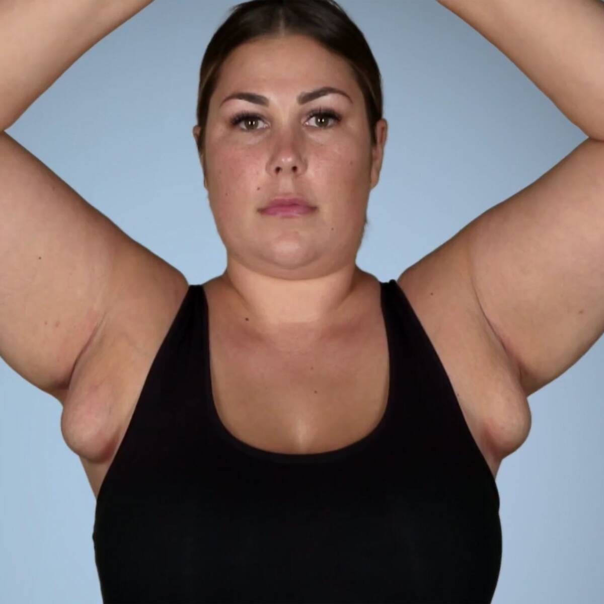 if-you-have-a-lump-in-your-armpit-here-s-what-it-could-mean-swollen