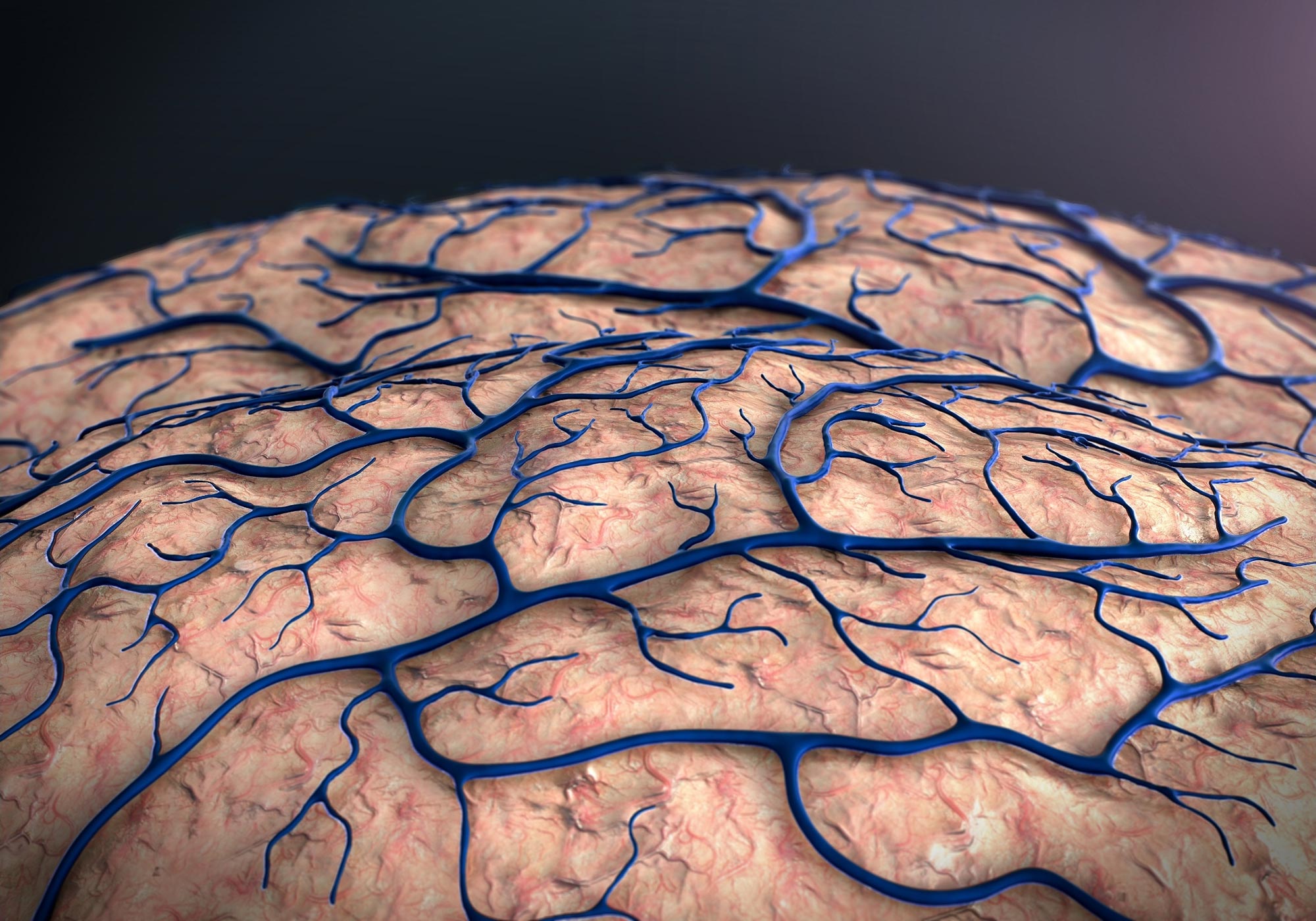 Schizophrenia: Brain Capillary Structures Show a Correlation With Their Neuron Structures