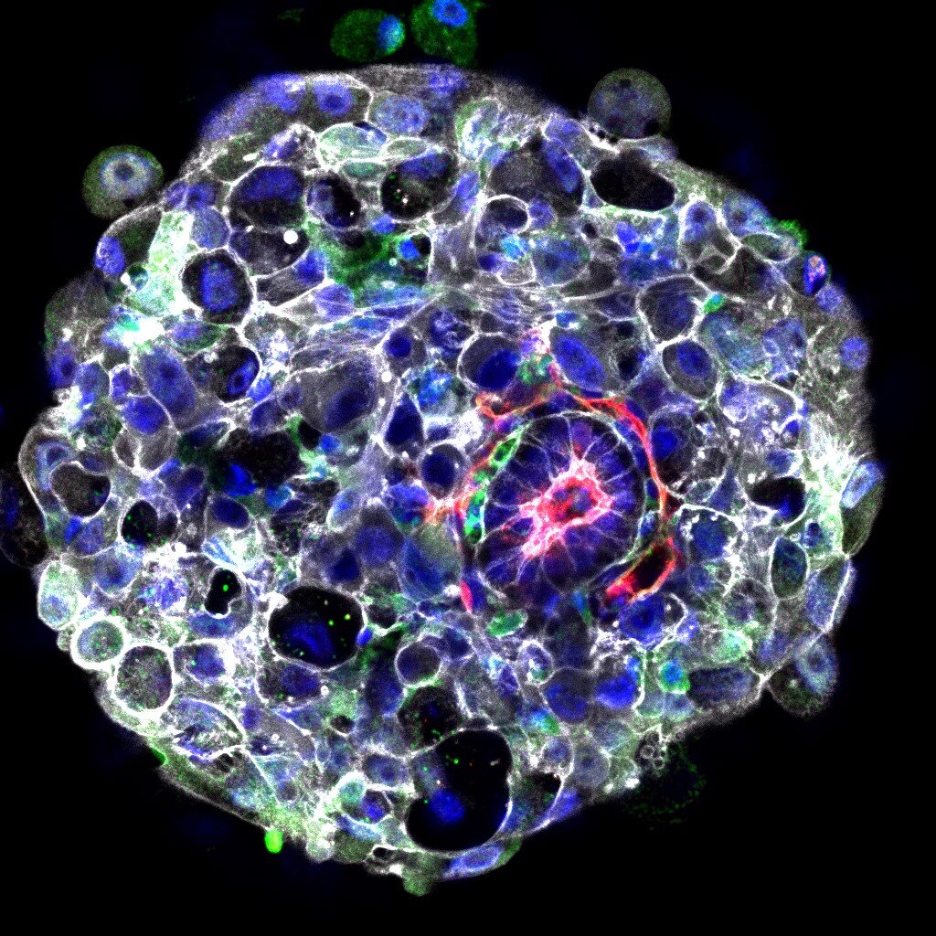Study identifies trigger for 'head-to-tail' axis development in human embryo