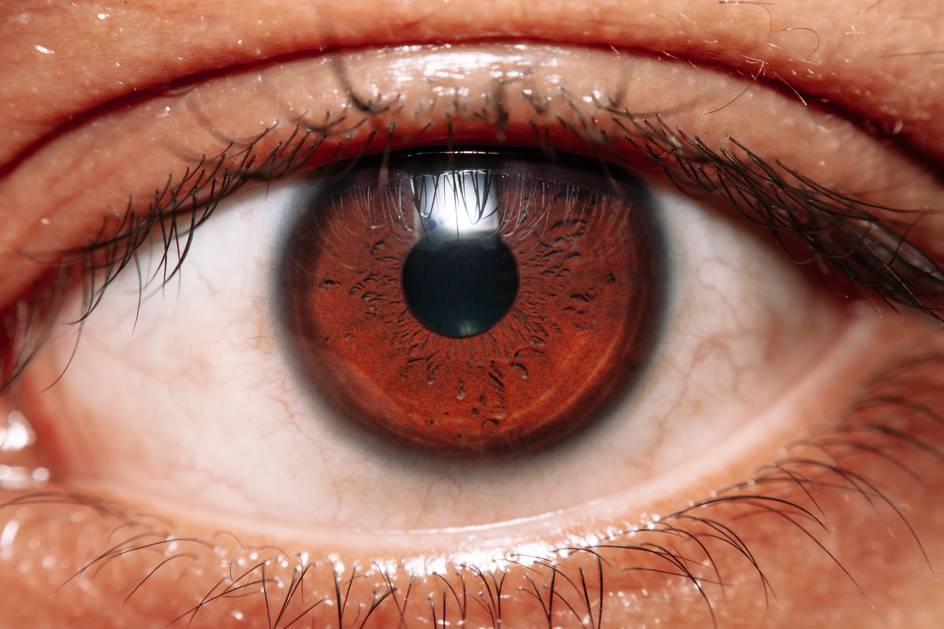 Will you develop Alzheimer's disease? Early signs could be detected in your eyes before symptoms arise