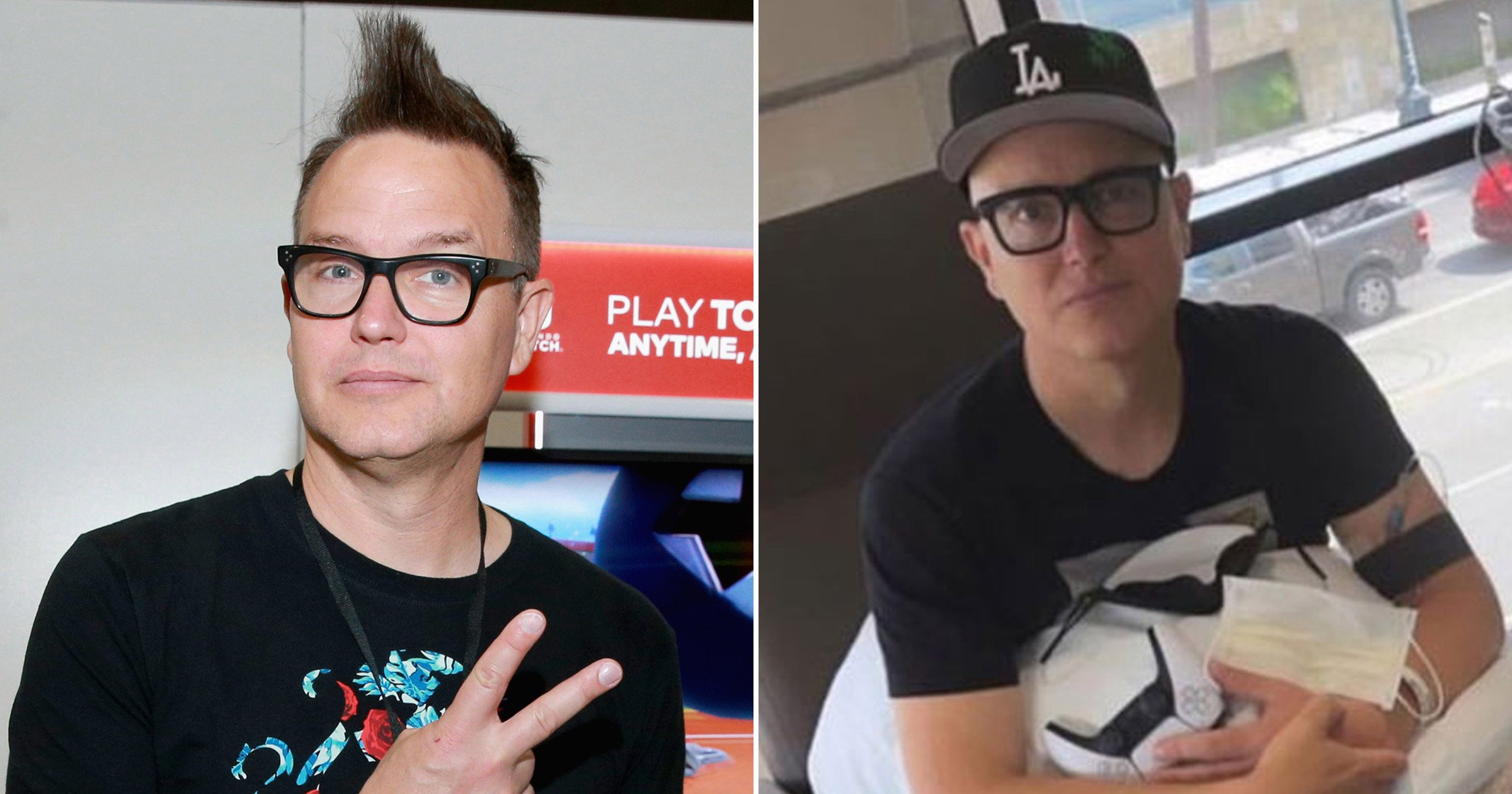 Blink-182’s Mark Hoppus displays bald head as he undergoes chemotherapy